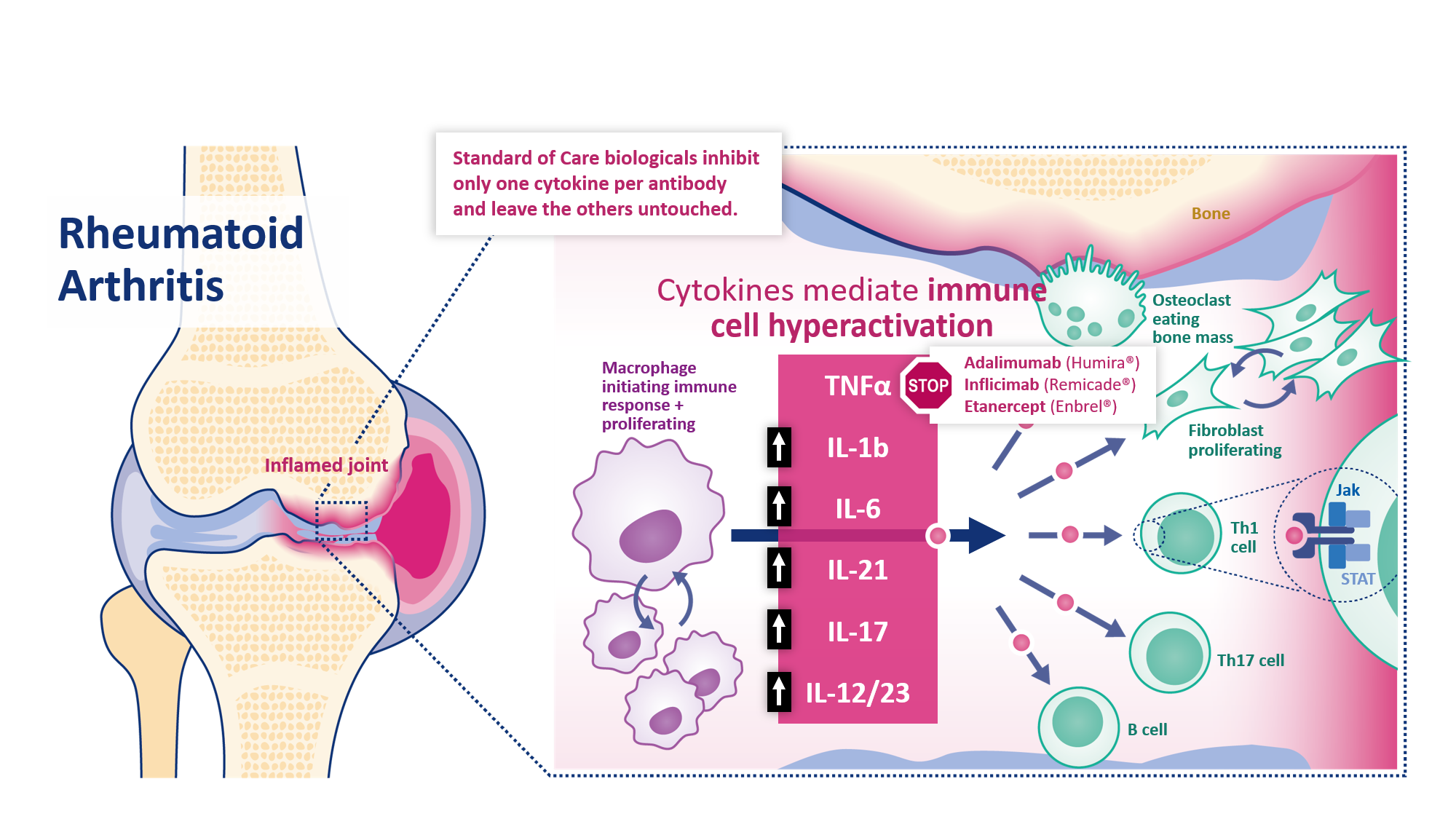 Rheumatoid Arthritis